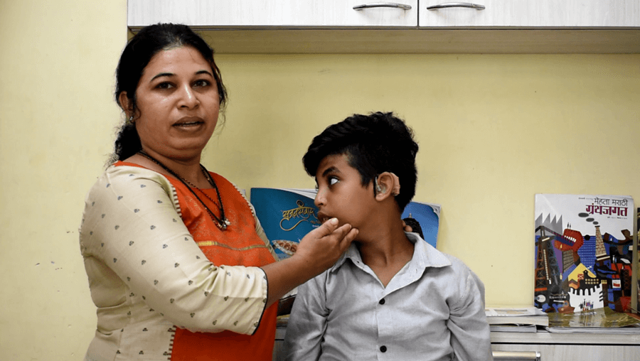 Purchase of Cochlear Implant